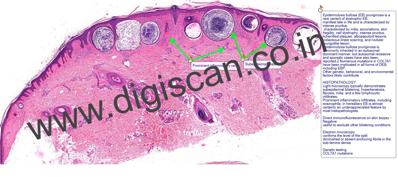 Dermatopathology Quiz Cases (Digital Slides for PG Exam & Self-Assessment)